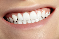 치아미백제 관련 허위‧과장 광고가 올해 들어 큰폭으로 증가하고 있다.