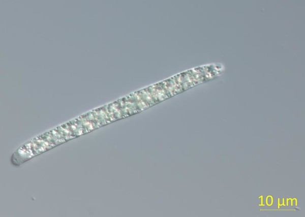 Planktothricoides raciborskii 미분간섭현미경 사진(×1000배) /사진제공=경기도보건환경연구원