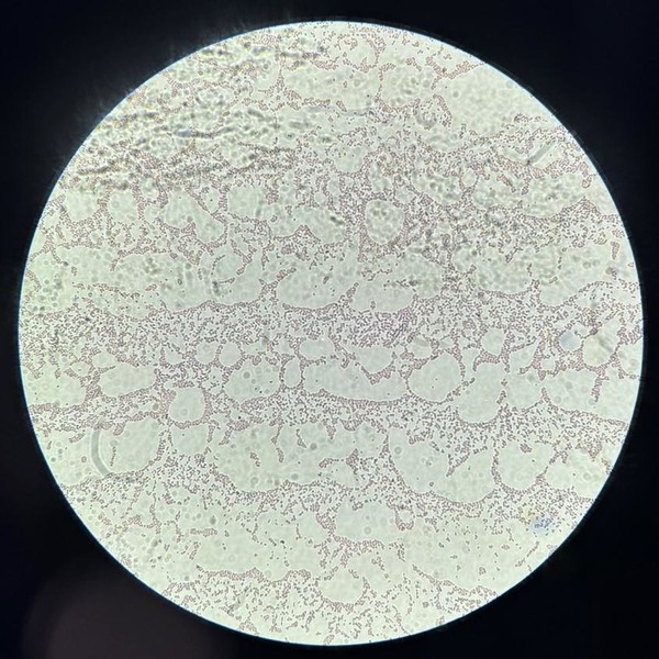 유해한 세균 대장균(E.coli)