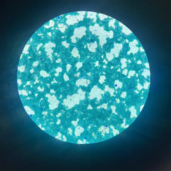 혈액 속 백혈구 관찰 사진, 파란색이 백혈구