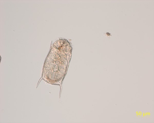 동물플랑크톤 윤충류(Keratella) /자료제공=보건환경연구원