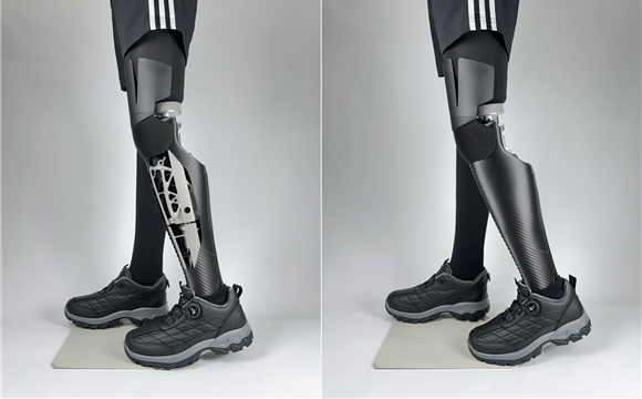 생체모사형 제너레이티브 의족 /사진제공=근로복지공단