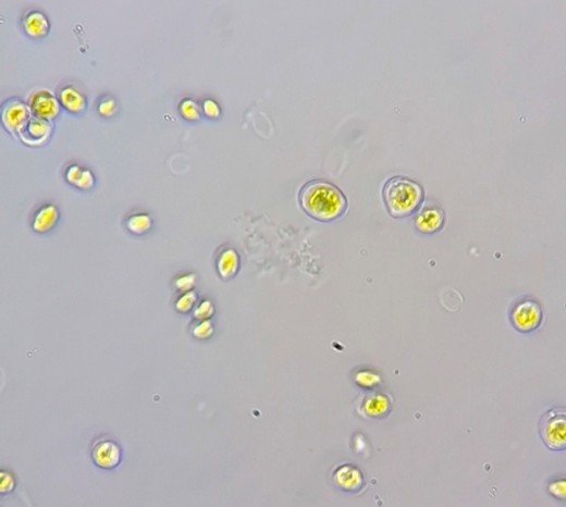 테트라데스무스 오블리쿠스(Tetradesmus obliquus) 화상자료 /사진제공=국립낙동강생물자원관